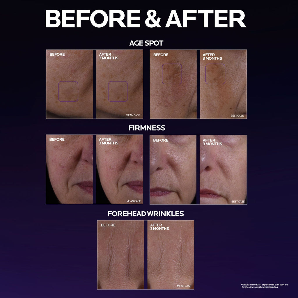 Mela B3 Double Dose Discoloration Treatment with Melasyl™